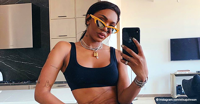 Magic Johnson's Daughter Elisa Shows Scars She Got after Home Invasion Escape