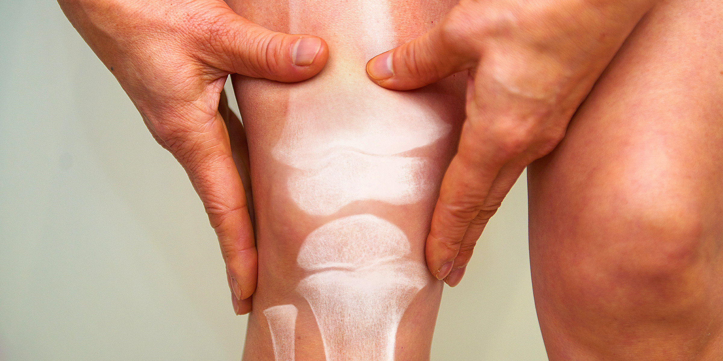 A graphic representing join pain | Source: Getty Images