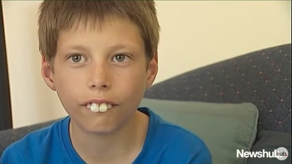 Niño de Nueva Zelanda fue acosado durante años por el tamaño de sus dientes. | Foto: YouTube/NewsHub