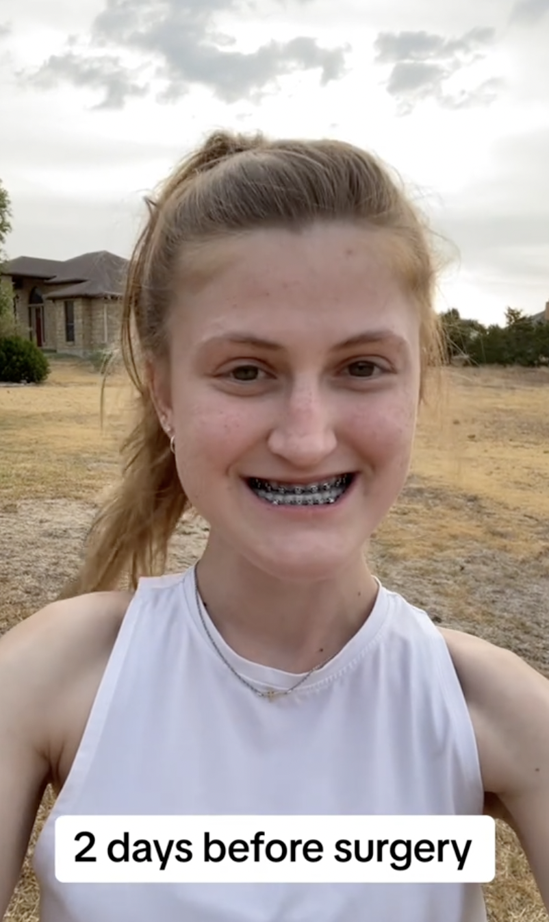 Virginia Elder smiles for the camera just two days before undergoing double jaw surgery. | Source: TikTok/virginiaeelder