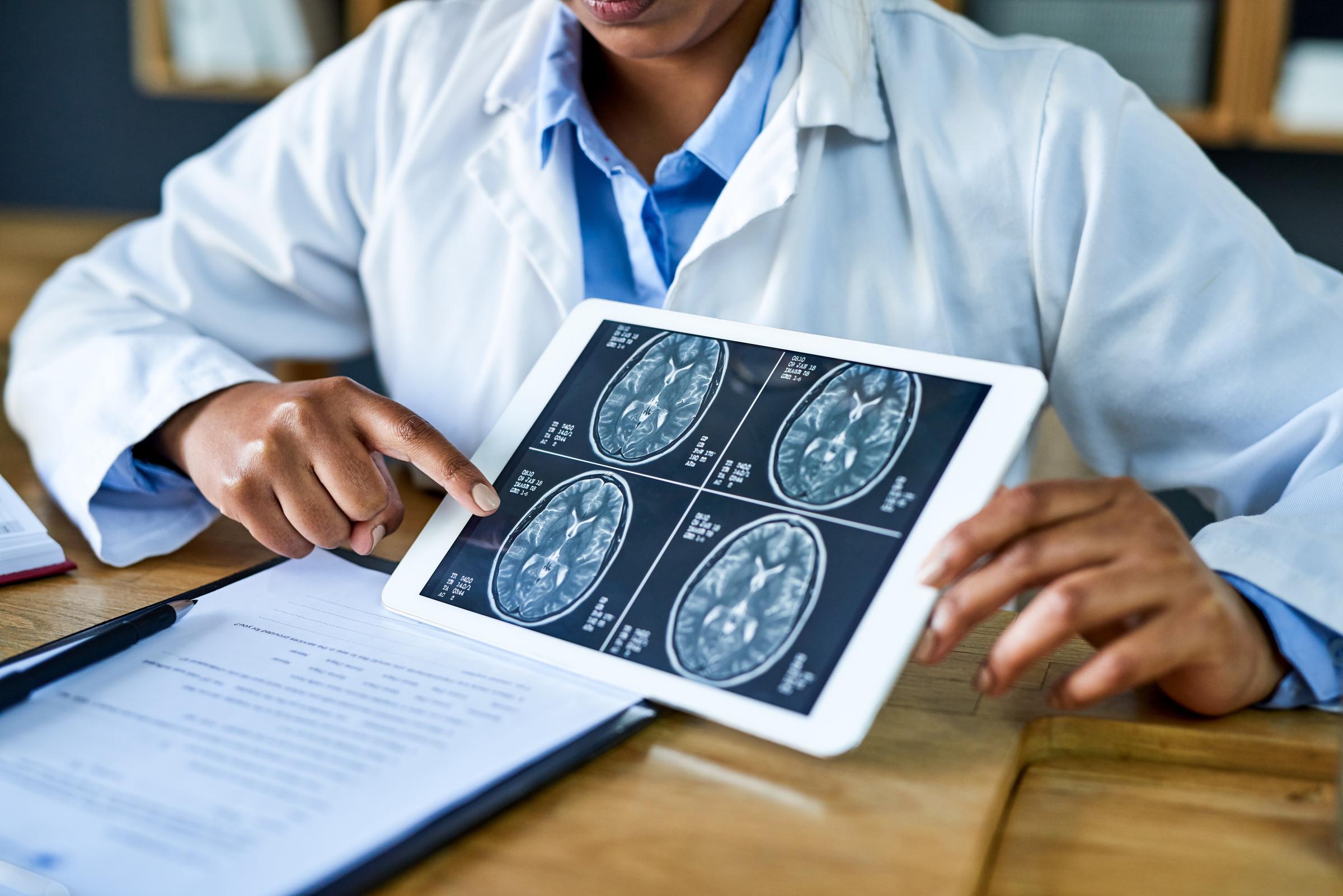Doctor uses a digital tablet to explain brain scan results during a clinical consultation | Source: Getty Images