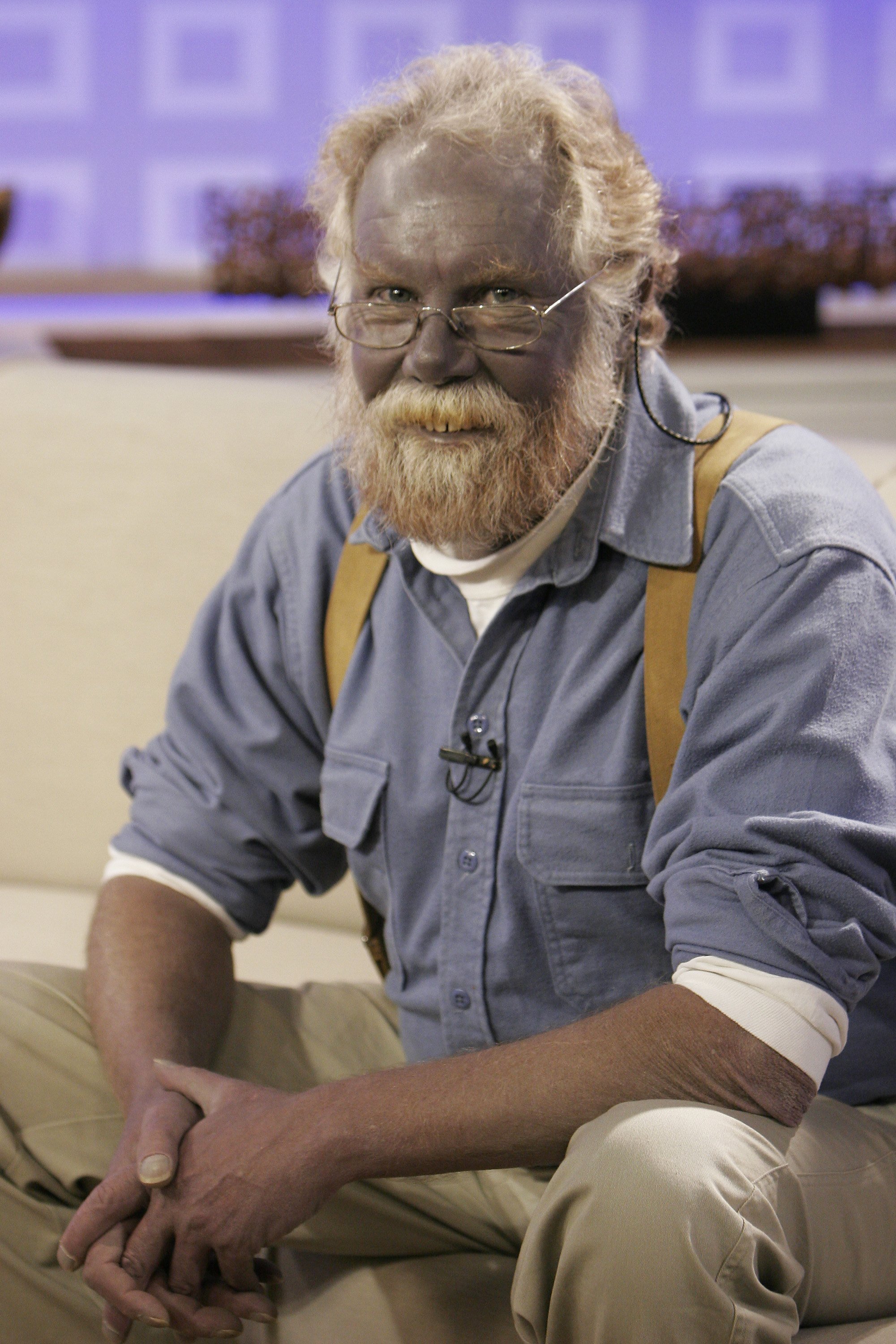 Paul Karason talks exclusively with NBC News' "Today" about turning permanently blue after using colloidal silver on January 7, 2008. | Source: Getty Images