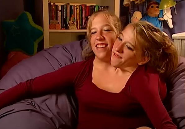 Conjoined twins Abby and Brittany Hensel | Source: YouTube/Screen Static