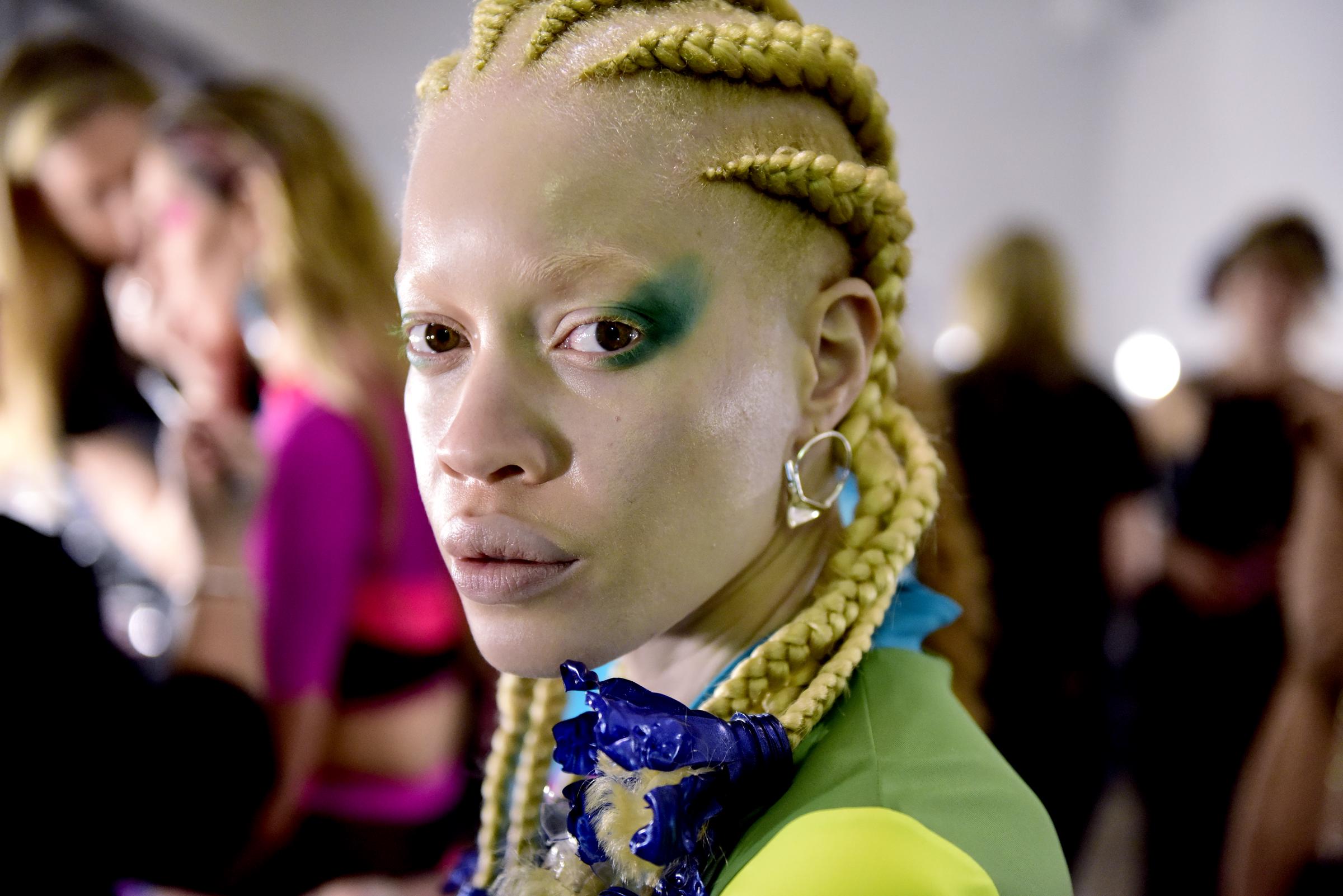 Diandra Forrest pictured backstage during the New York Fashion Week on March 2, 2018 | Source: Getty Images