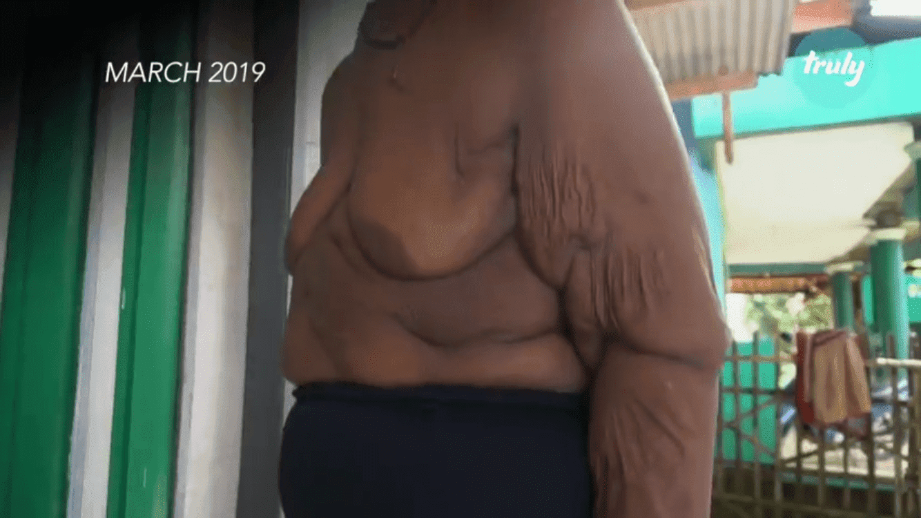 Arya Permana during his weight loss journey, in his home | Photo: Youtube/Barcroft Tv