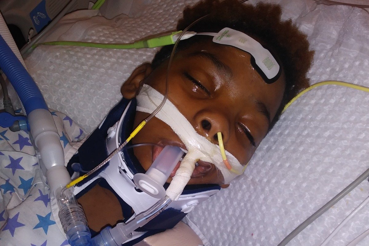 Jamari Dent on life support at the hospital. | Photo: GoFundMe/Tierra Black