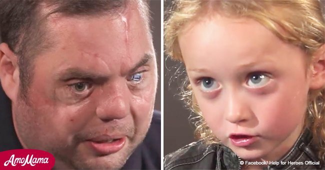 Disfigured vet meets 5-year-old girl. Then he says 'Hi' to her