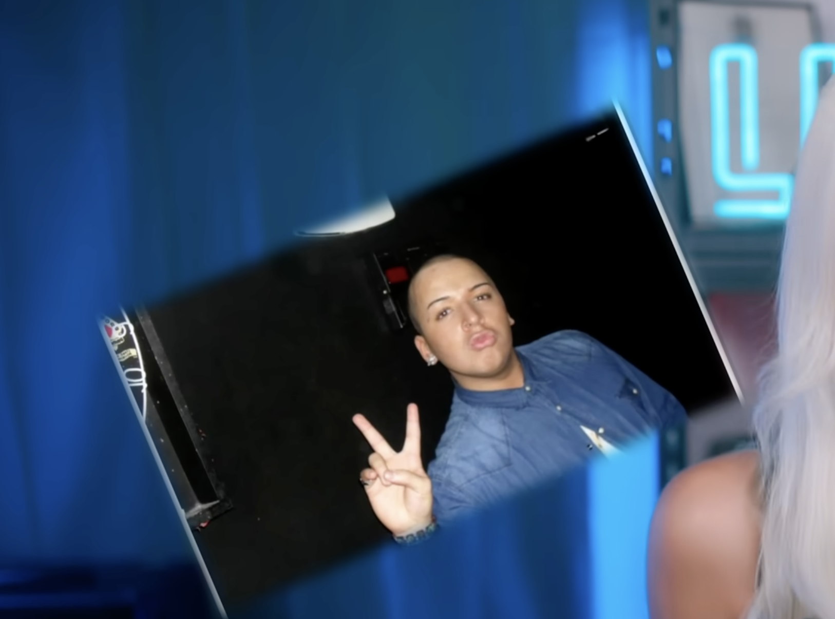 Jordan James Parke before his cosmetic procedures | Source: YouTube/Luxeria