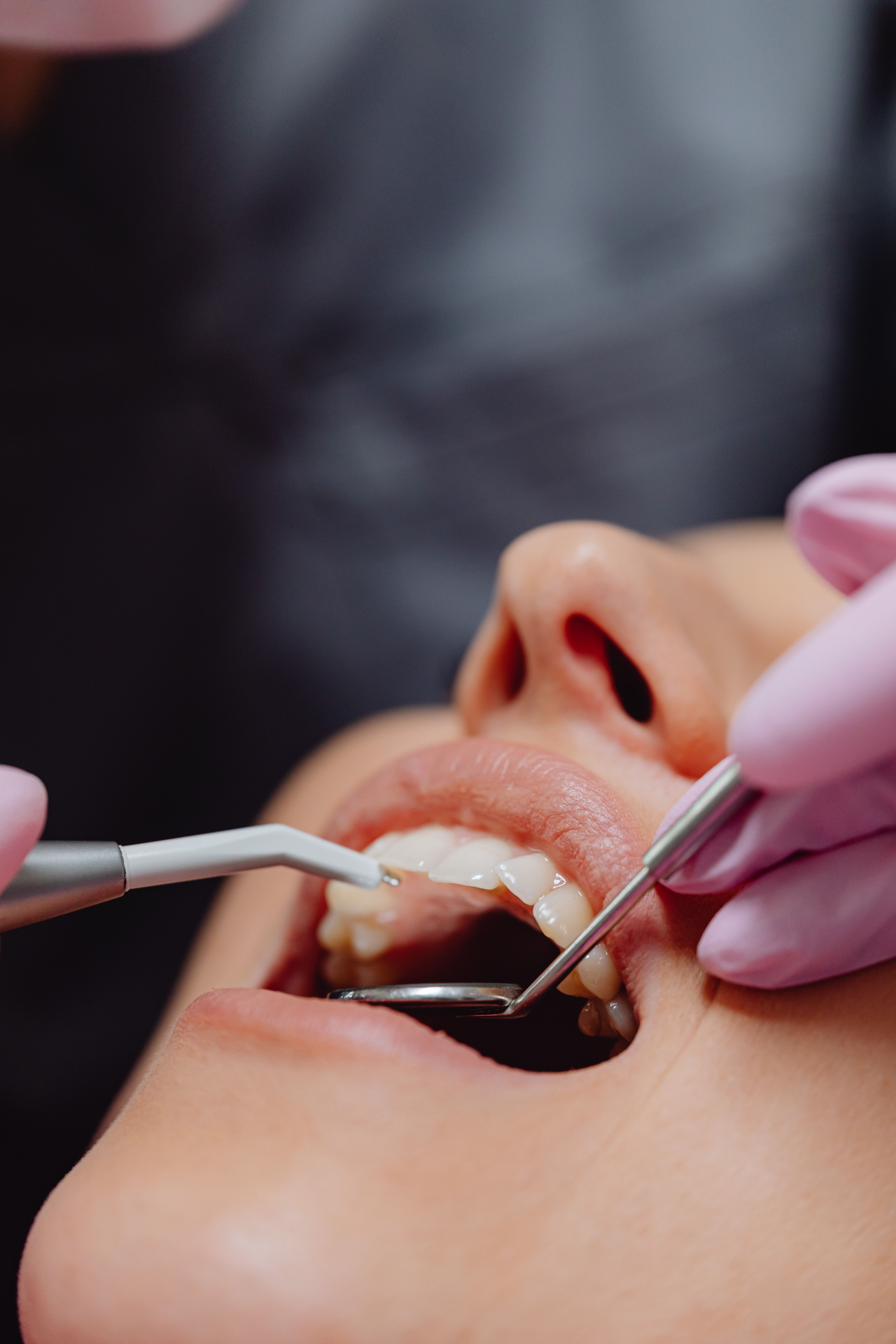 A person getting their gums checked | Source: Pexels