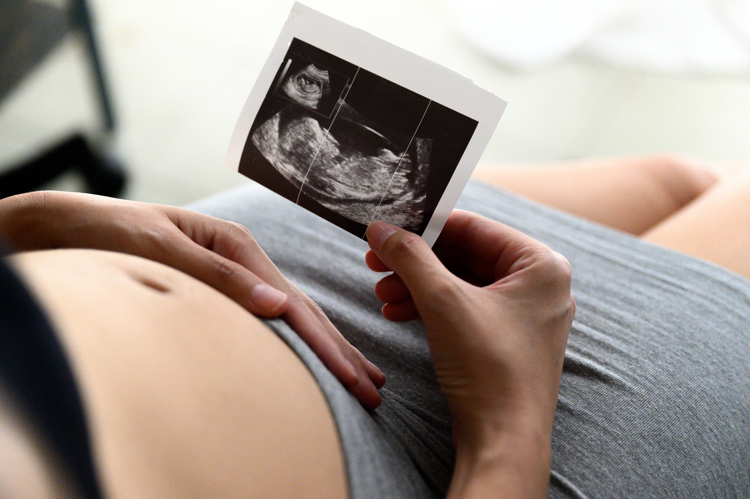 Mujer embarazada. | Foto: Shutterstock