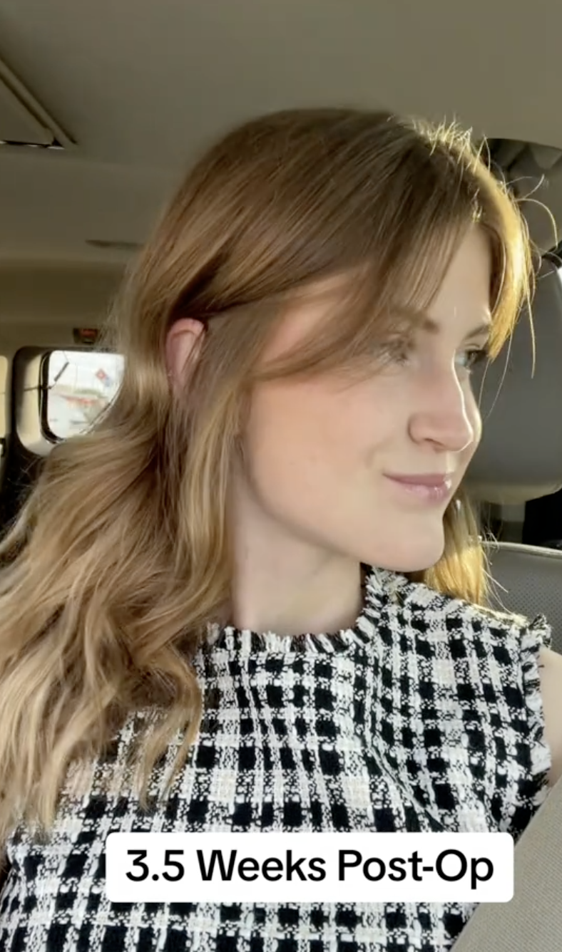 Virginia Elder looks to the right, showing the change in her jaw. | Source: TikTok/virginiaeelder