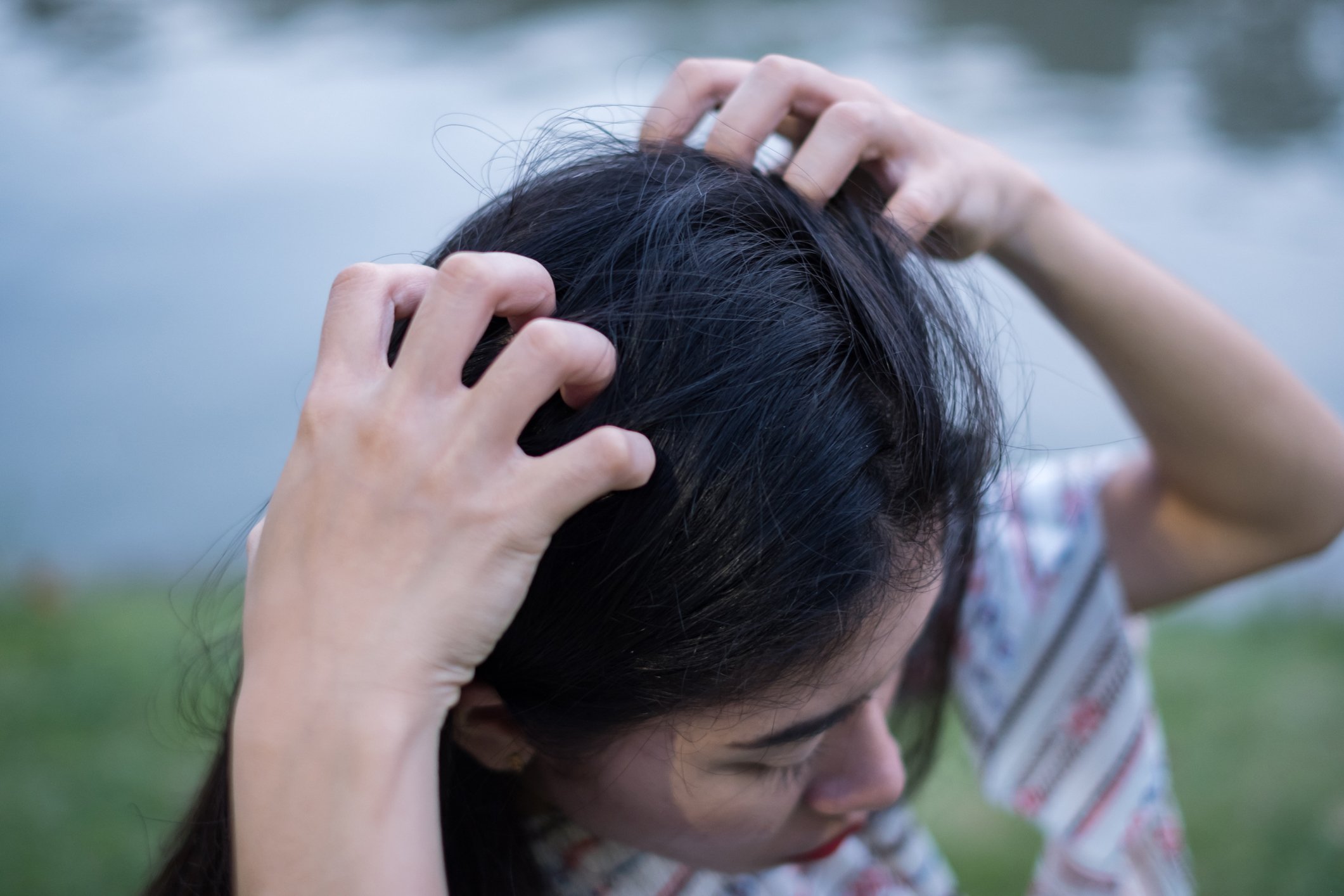 Une femme qui se gratte les cheveux. | Photo : Getty Images