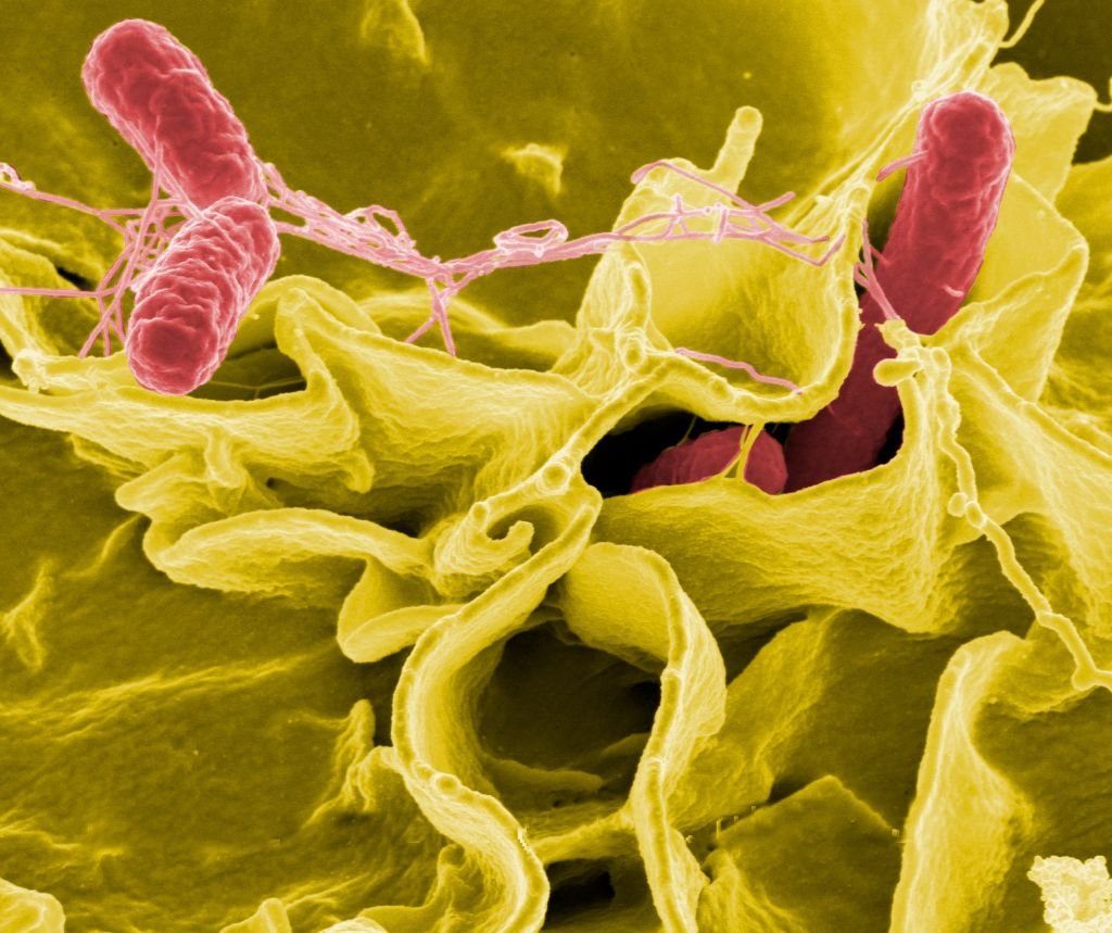 Salmonella bacteria, a common cause of foodborne disease, invade an immune cell. Credit: NIAID on October 31, 2020 | Photo: Getty Images