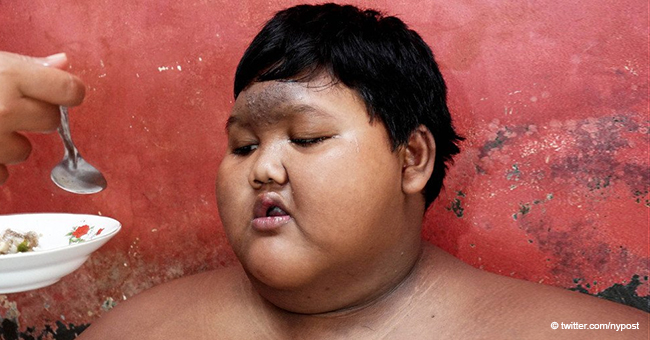 Der schwerste Junge der Welt, der krankhaft fettleibig war, verlor über 110 kg