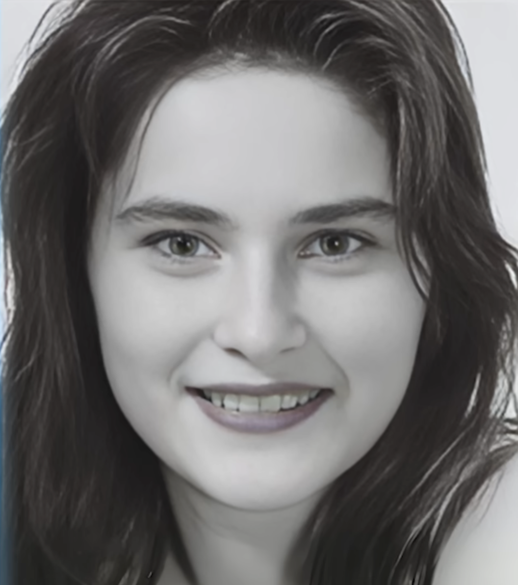 Photographed at 17, Melania Trump showed the features Dr. Gary Linkov later cited as her baseline, including full eyebrows, almond-shaped eyes, and a softer nose tip. | Source: Youtube/drgarylinkov