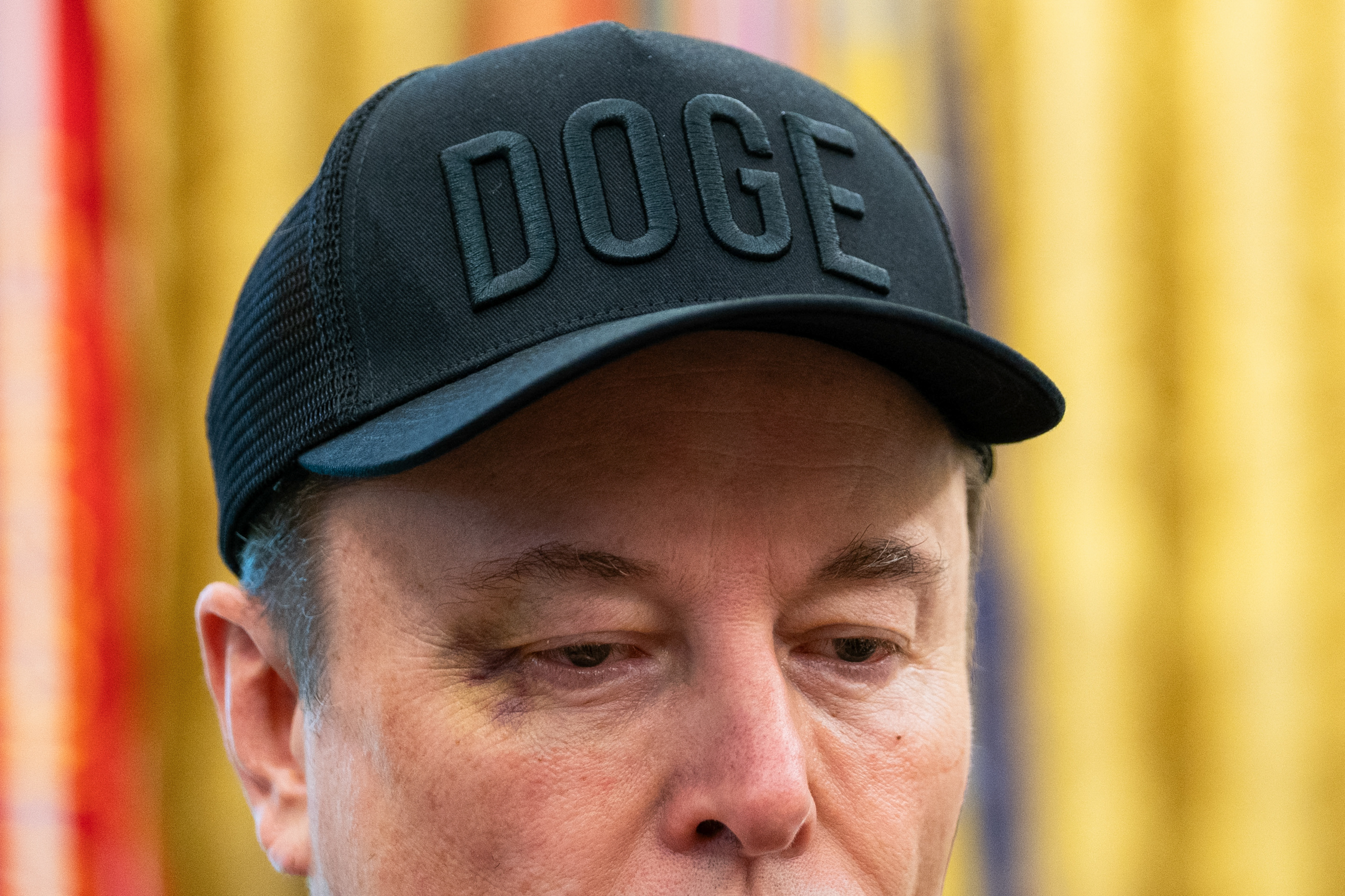 As he said farewell to his government post, it was his bruised face, not his policies, that stole the spotlight.