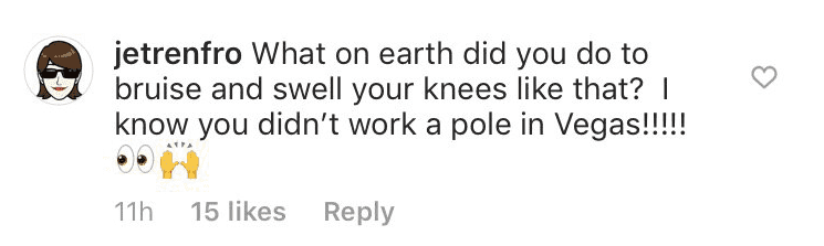 Another comment from a fan questioning how she got the injury | Instagram: @marieosmond