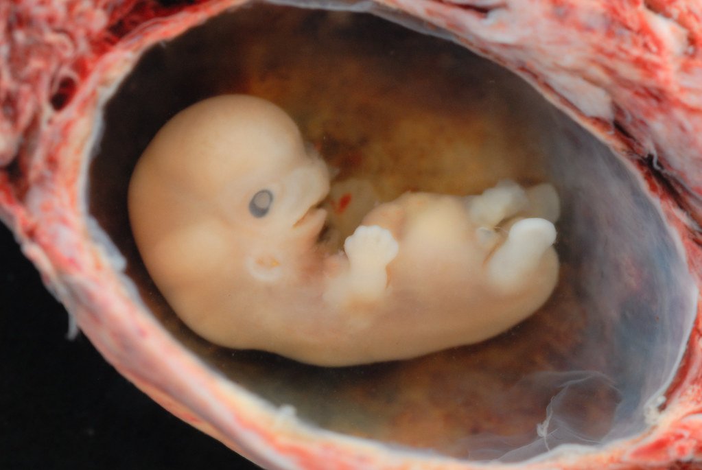 Embrión humano. | Foto: Flickr
