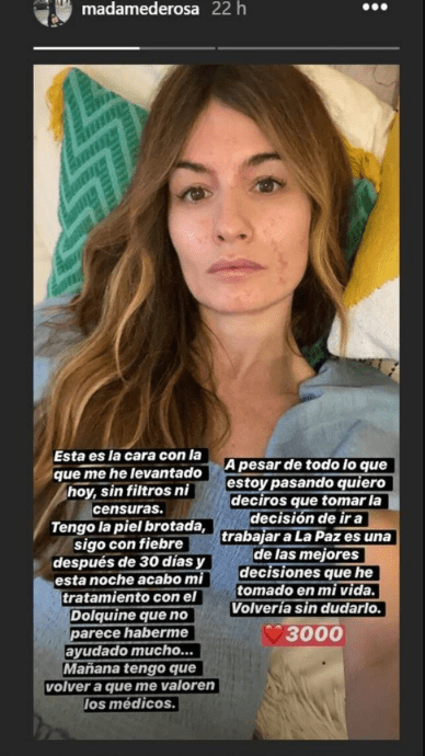 Madame de Rosa con erupciones en el rostro por fibre a causa del coronavirus. I Foto: Instagram/madamederosa