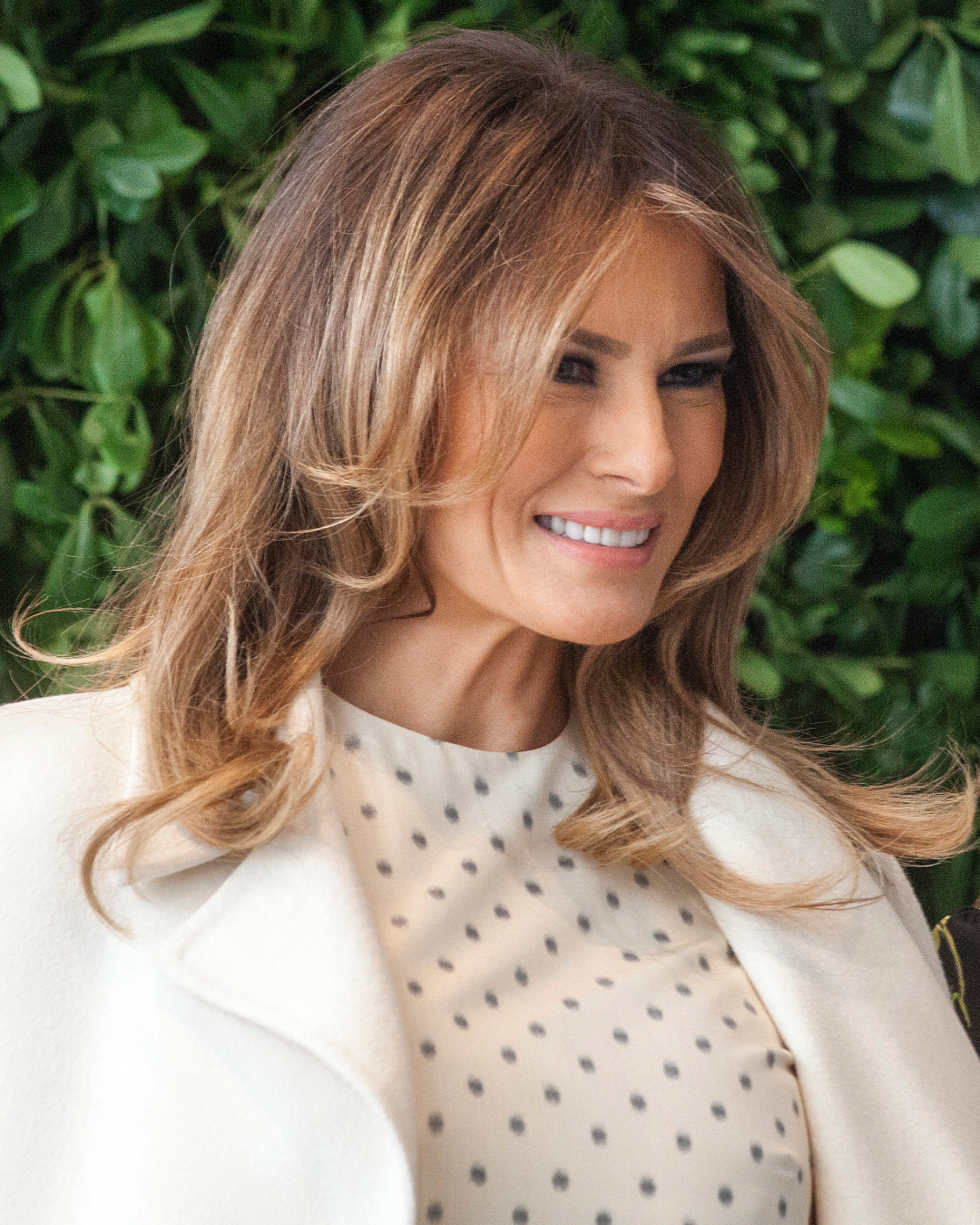 Taken a year later, this image shows many of the same defining facial features seen in earlier photographs. The consistency of her overall appearance provided another reference point for experts assessing possible cosmetic procedures and age-related changes. | Source: Getty Images