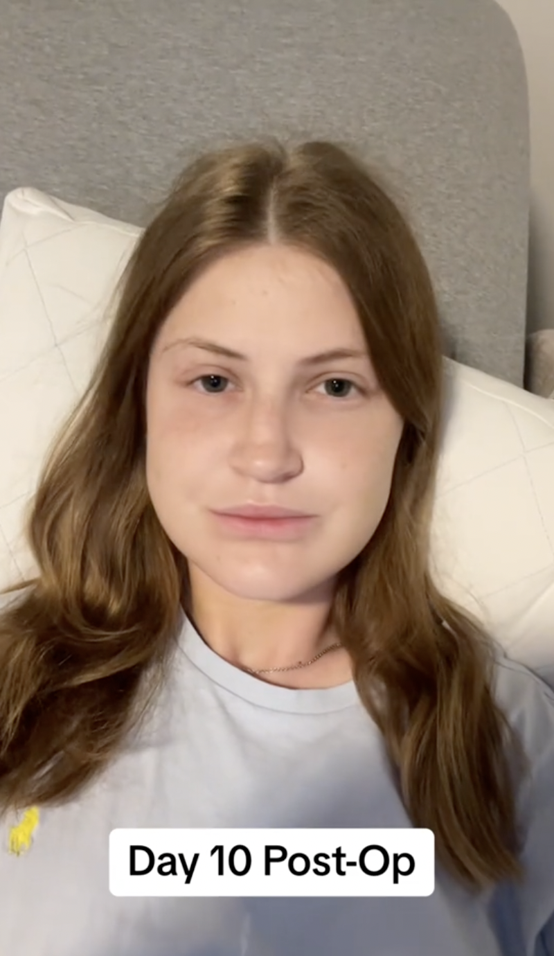 Virginia Elder resting at home 10 days after surgery, showing a calm and composed expression. | Source: TikTok/virginiaeelder