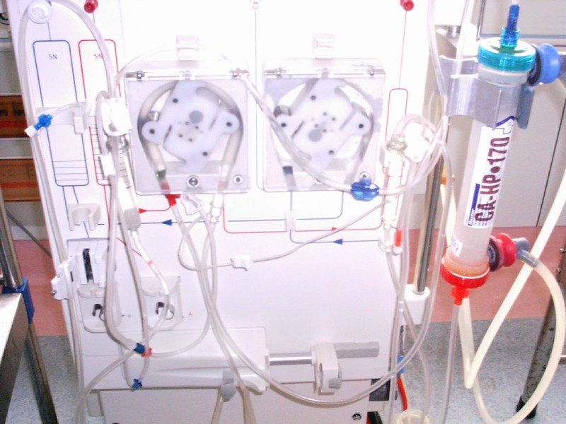 A dialysis machine. | Photo: Flickr
