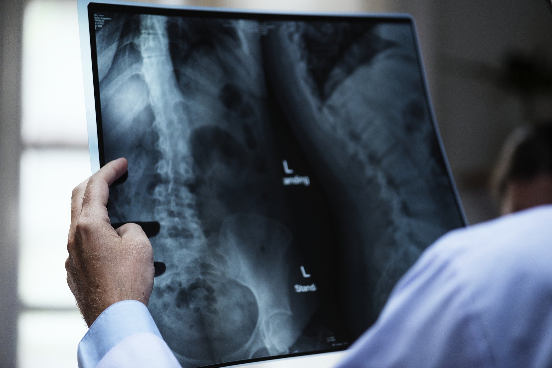 Radiografías de huesos. Fuente: Pixabay