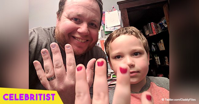 Dad who painted his nails in solidarity with bullied 5-year-old son still melts hearts