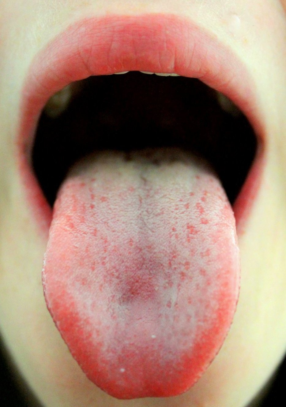 Persona con la boca abierta y lengua afuera | Imagen tomada de: Wikimedia Commons
