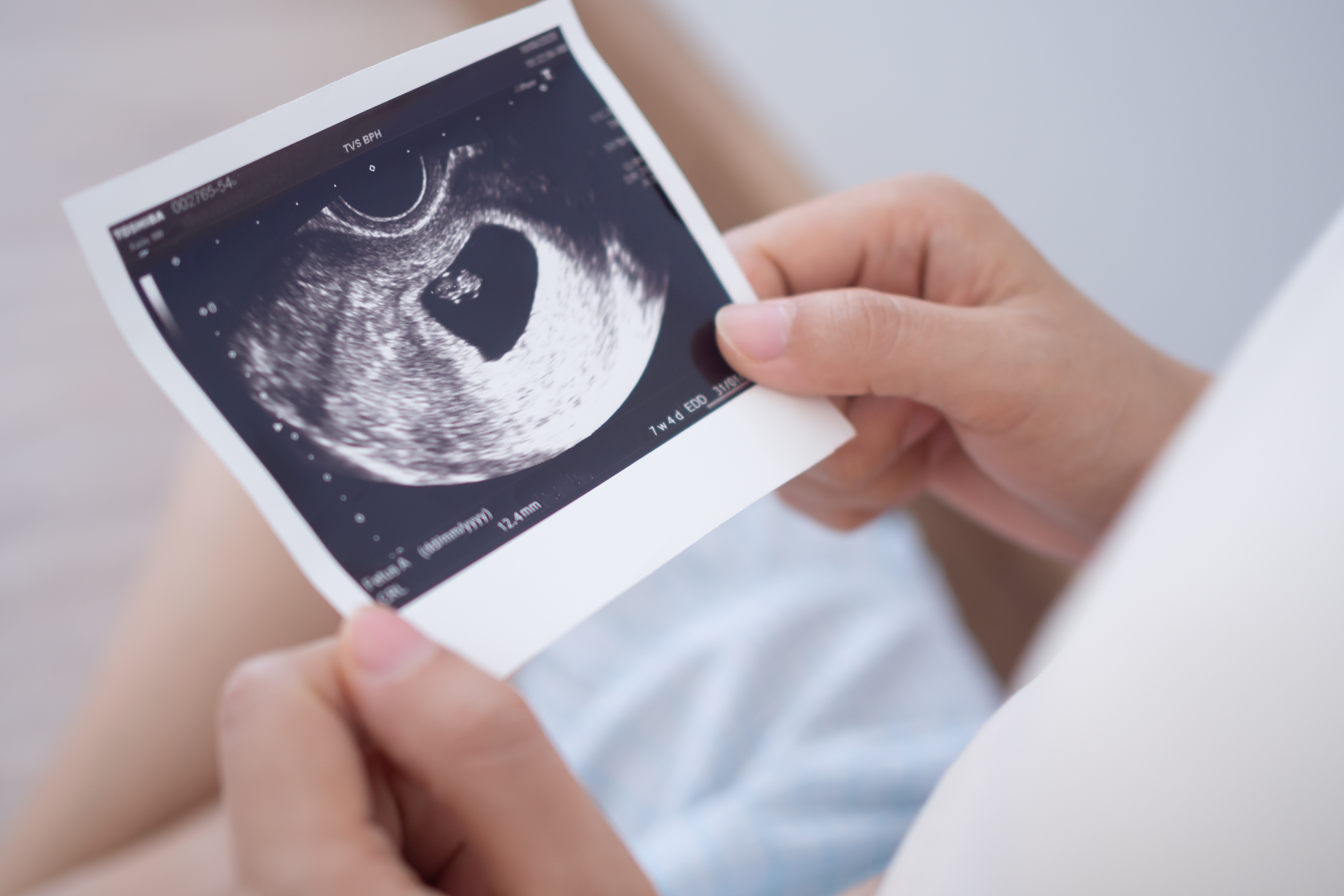 Pregnant woman looking at an ultrasound photo of fetus | Source: Shutterstock