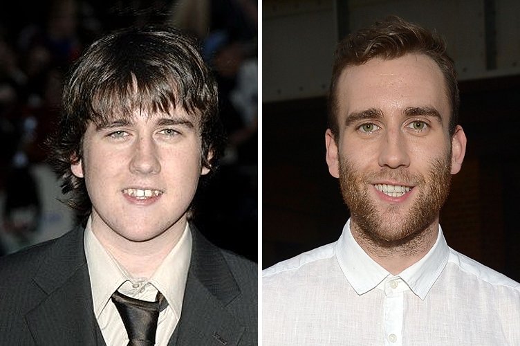 Matthew Lewis avant et après. ǀ Source : Getty Images