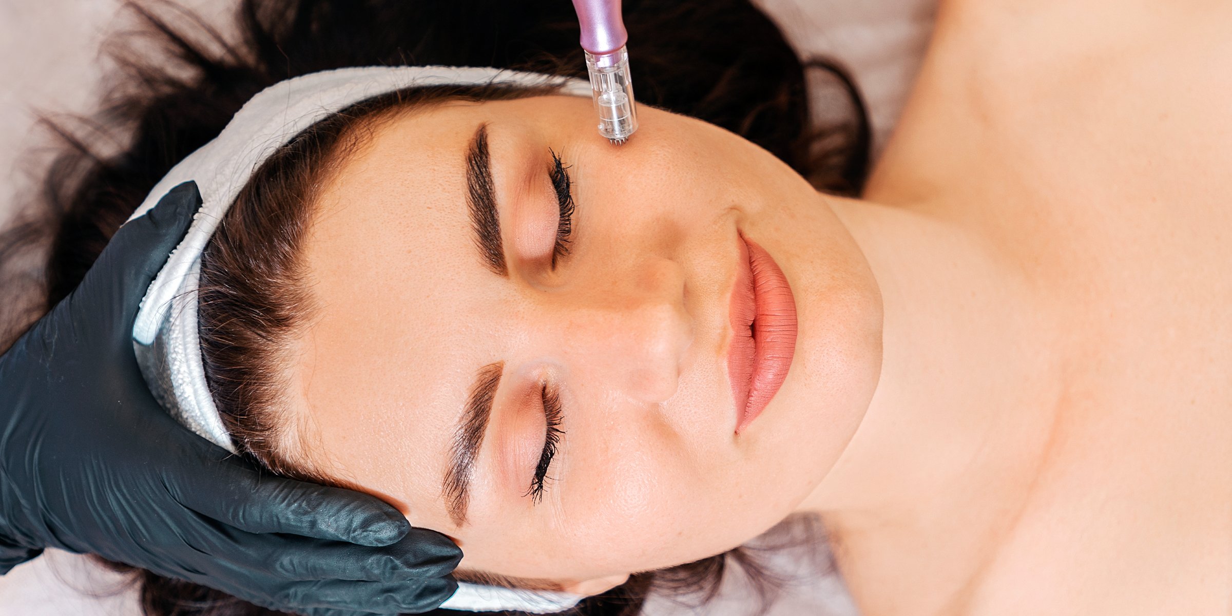 Woman undergoing microneedling. | Source:  Getty Images