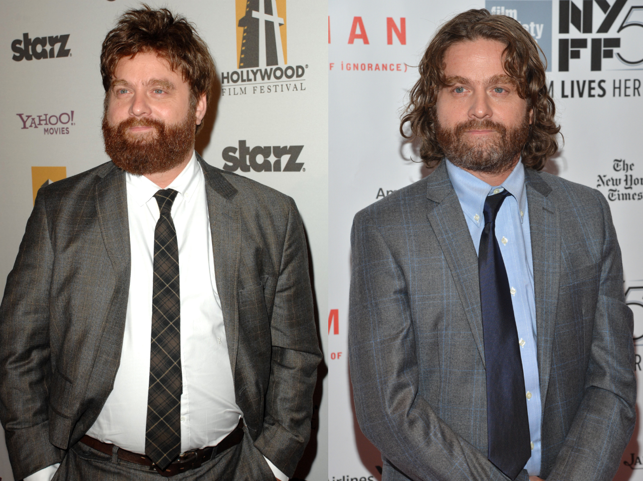 Zach Galifianakis' transformation, before and after his impressive weight loss | Source: Getty Images