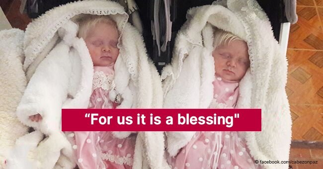 Rare newborn albino-twins caused a sensation in Argentina
