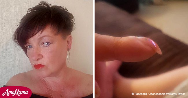 Woman discovers her 'ugly' nails were a sign of cancer after posting picture on Facebook