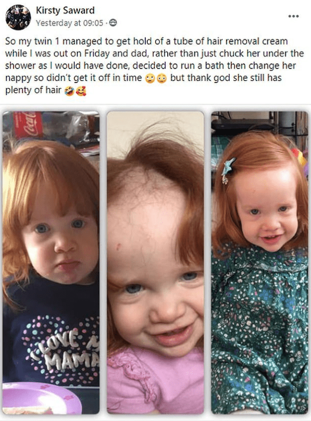 El antes y el después de aplicarse la crema depilatoria de Maisie Saward. | Foto: Captura Facebook/Kristy Saward