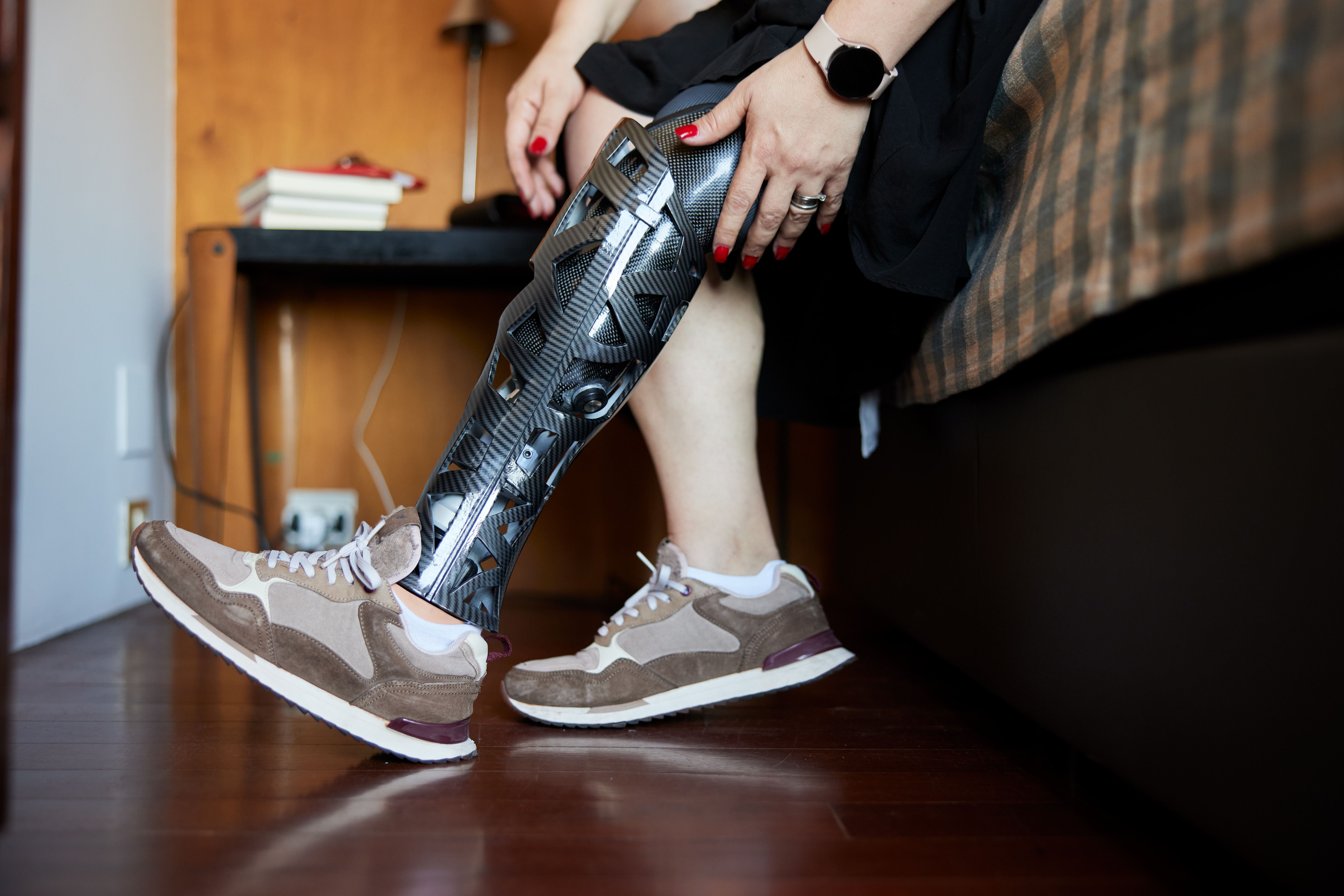 A person with a prosthetic leg | Source: Shutterstock