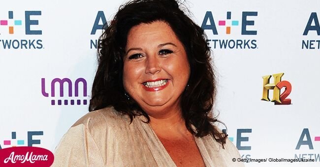 ‘Dance Moms’ Abby Lee Miller looks completely unrecognizable after drastic weight loss