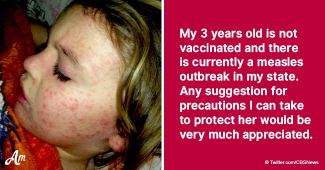 Mother of unvaccinated kid breaks the Internet with a question on how to protect from measles