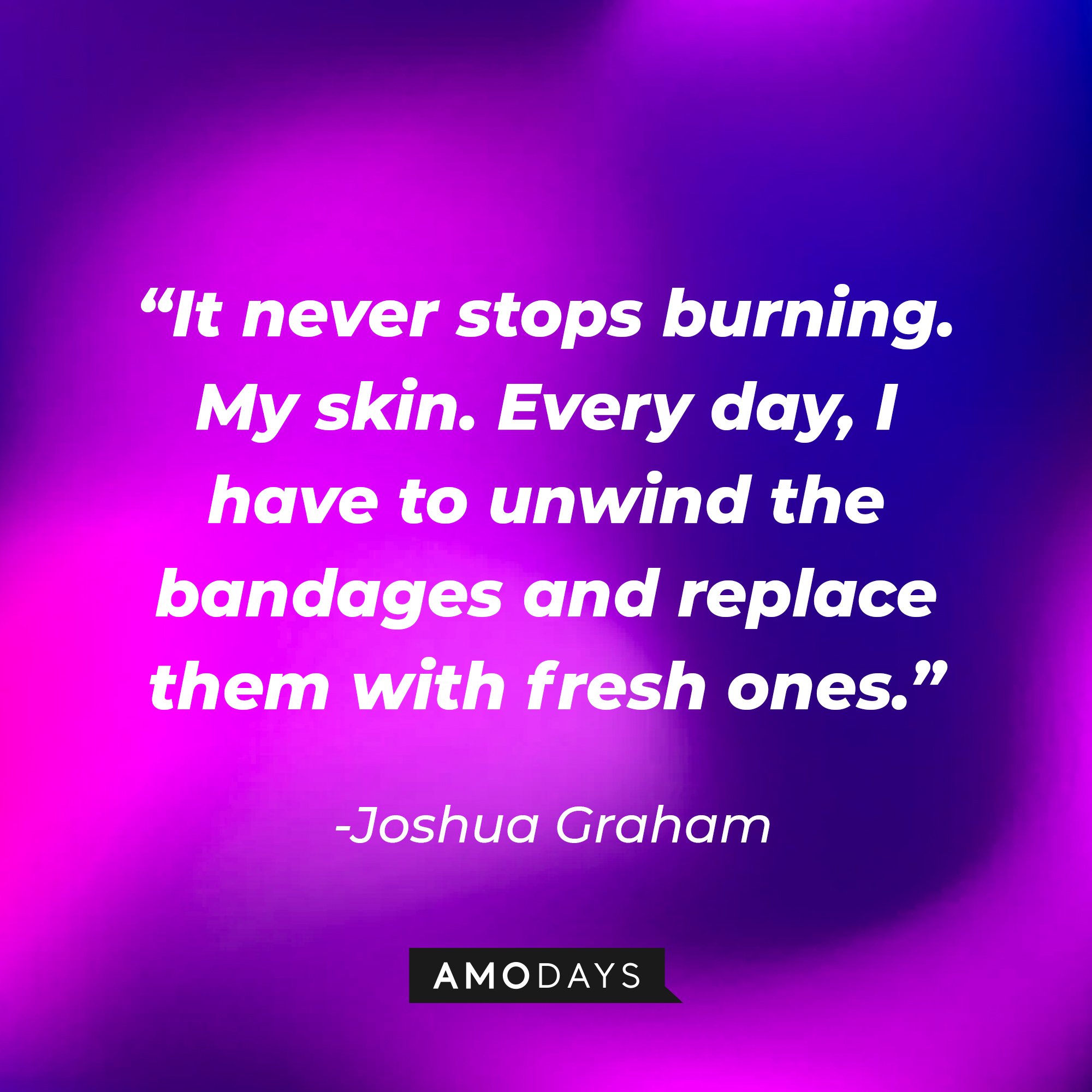 Joshua Graham's quote: “It never stops burning. My skin. Every day, I have to unwind the bandages and replace them with fresh ones.”   | Source: Amodays