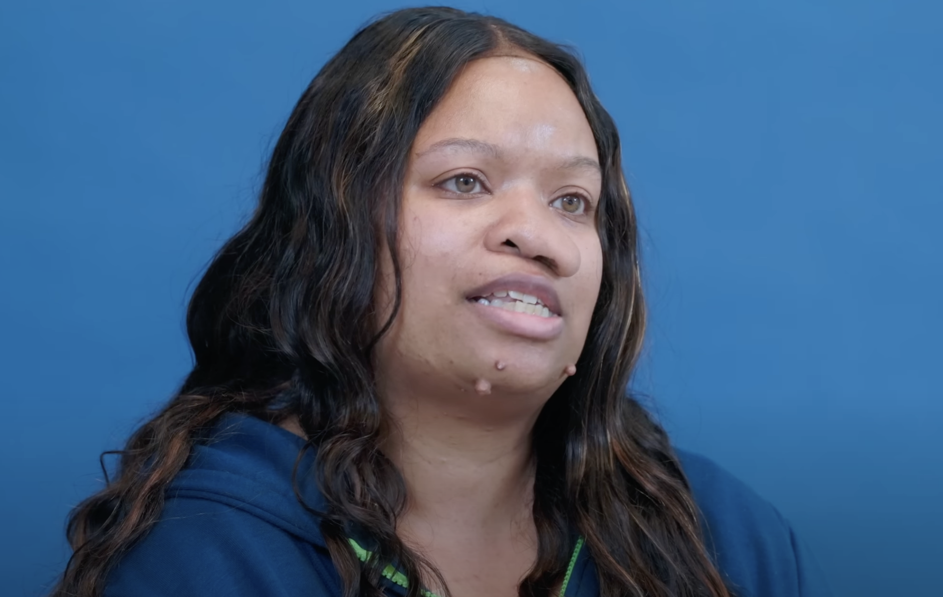 Danielle before surgery, dated August 2, 2024 | Source: YouTube/@Dr.Truesdale