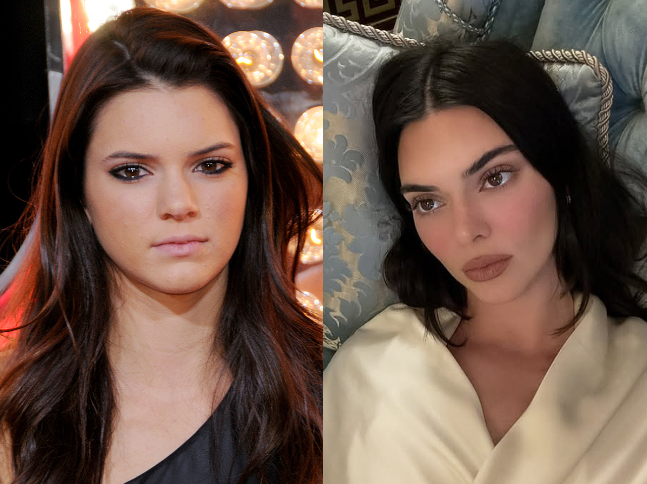 Kendall Jenner | Source: Getty Images | Instagram/kendalljenner