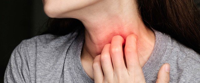 Une femme avec des maux de gorge. l Source : Flickr