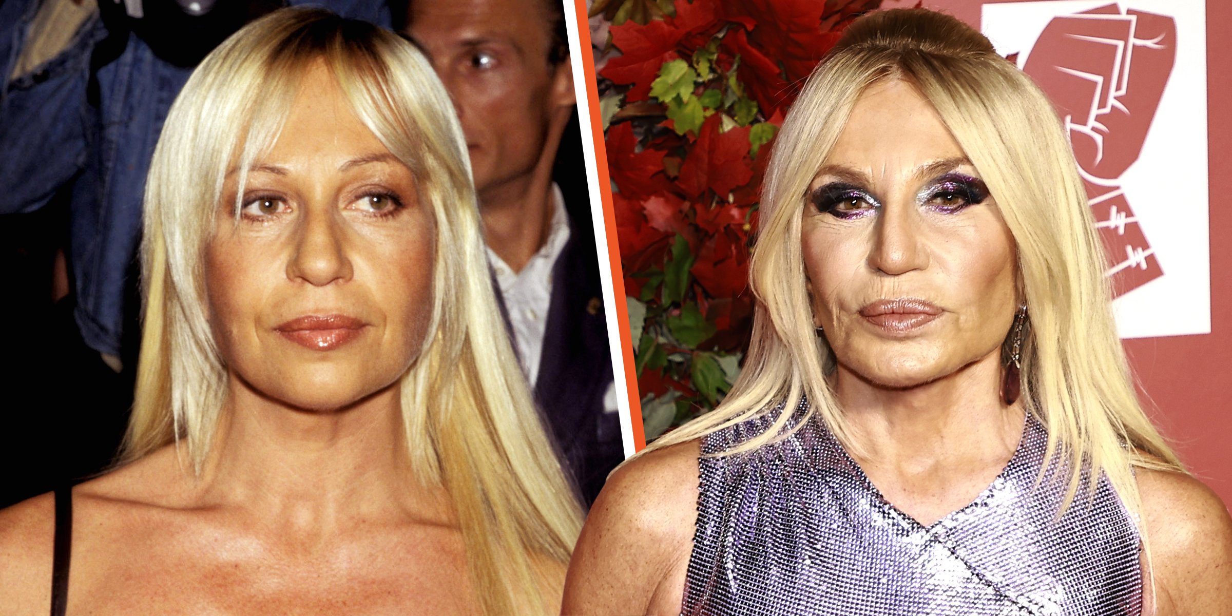 Donatella Versace Botox, Cirurgia plastica, Cirurgias