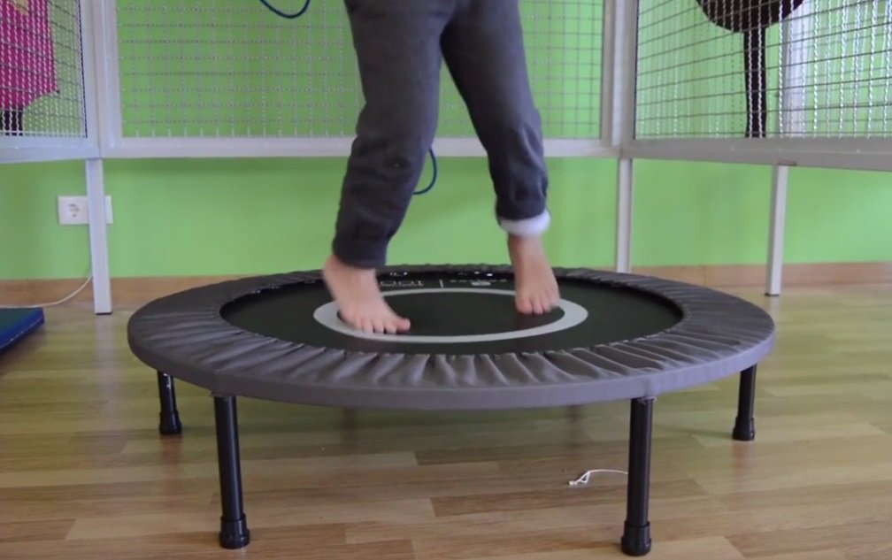 El pequeño Hugo saltando en un trampolín como parte de su terapia. | Imagen: YouTube/AMIGOSDEGALICIA El pequeño Hugo saltando en un trampolín como parte de su terapia. | Imagen: YouTube/AMIGOSDEGALICIA