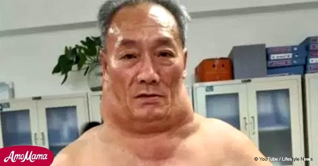 Meet the man who looks like 'The Hulk' after 30 years of heavy drinking left him disfigured