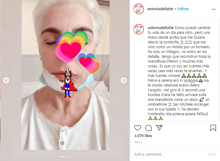 Antonia Dell'Atte con la mandibula vendada tras sufrir un accidente.I Foto: Captura de pantalla de instagram/antoniadellatte/