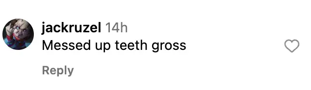 A screenshot of a candid comment on Facebook simply stating that Kate Moss' teeth are messed up. | Source: facebook.com/DailyMail