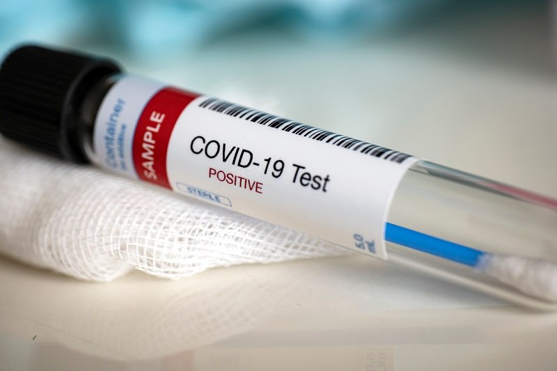 Tubo de ensayo para pruebas de covid-19. | Foto: Shutterstock