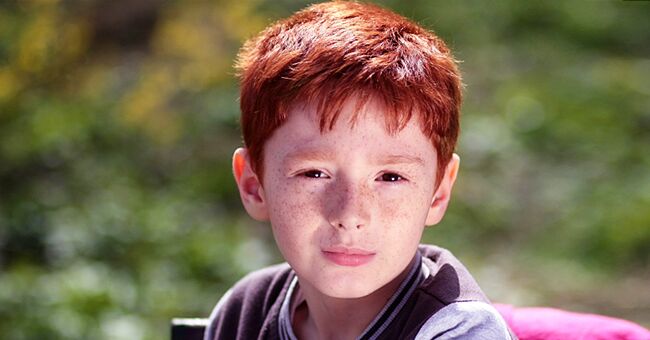 A freckle-faced boy | Photo: Pxhere.com